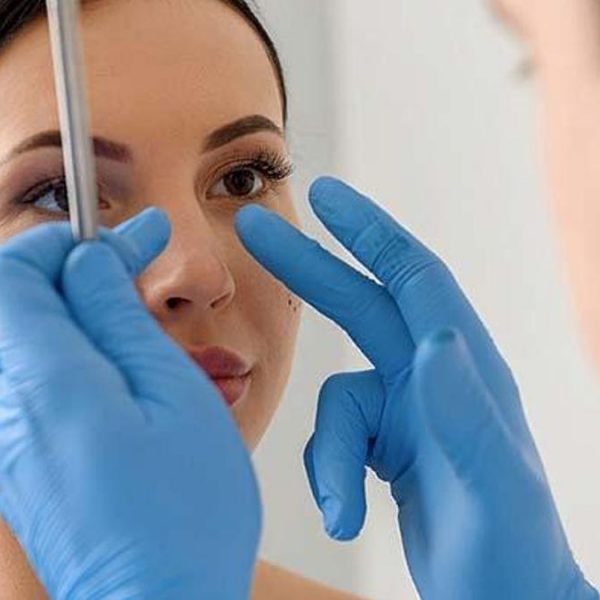 Rinoplasti Sonrası Değişen Sadece Burnunuz mu?